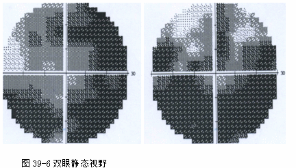 ZY016_212_2.gif